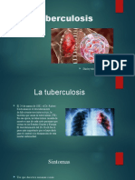 La Tuberculosis Final2