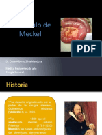 Diverticulo de Meckel