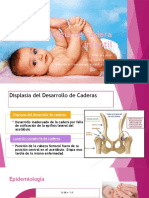 Patología de Cadera Infantil