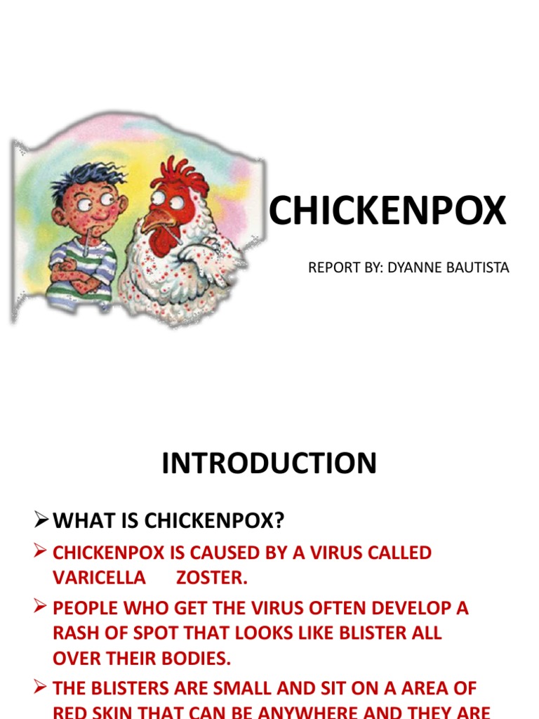 Chickenpox Overview and Prevention | PDF | Rtt | Public Health
