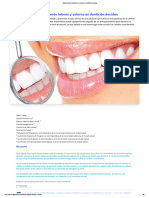 Blanqueamiento Interno y Externo en Dentición Decidua