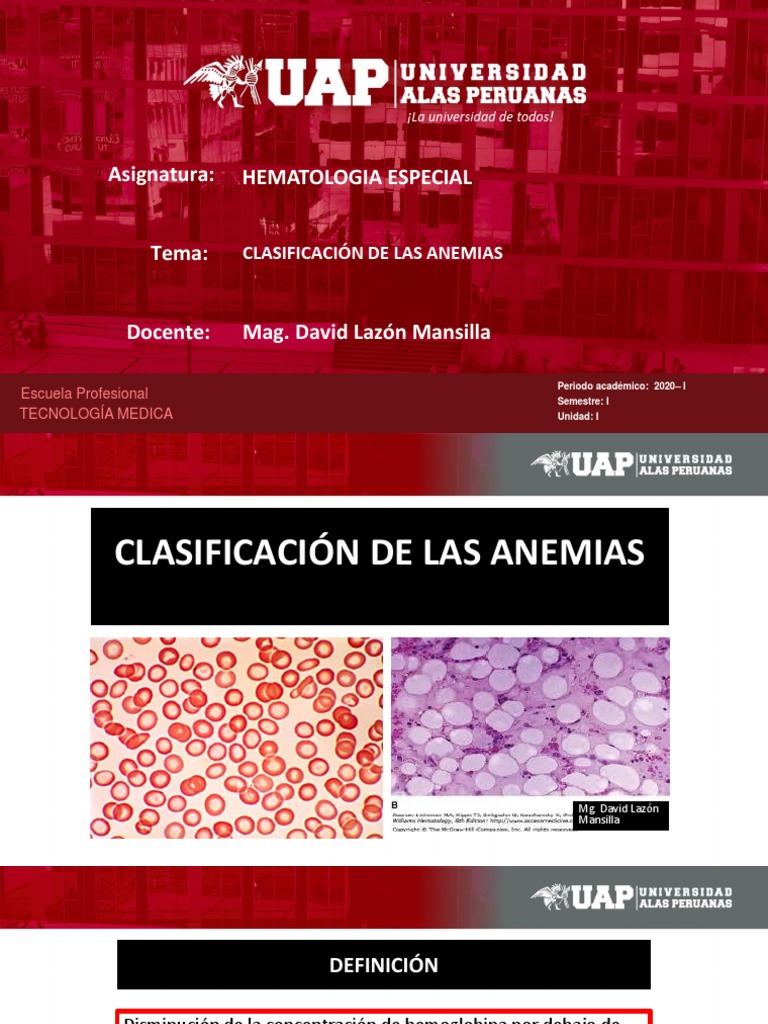Clasificación Morfológica de Anemias | PDF | Anemia | Glóbulo rojo