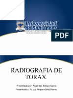 Radiografia de Torax