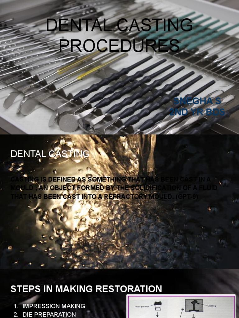 Dental Casting Procedures Snegha S 2Nd Yr Bds PDF Casting