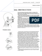 Nasal Obstruction: Abc of en T