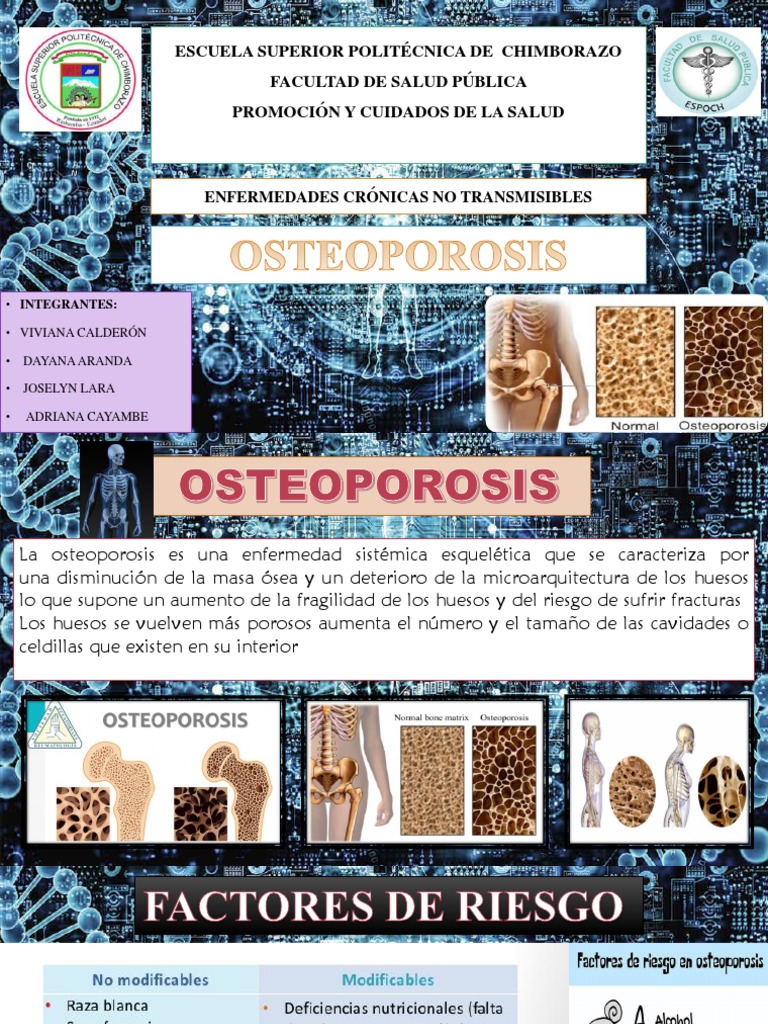 Prevención y Tratamiento de Osteoporosis | PDF | Osteoporosis | Hueso