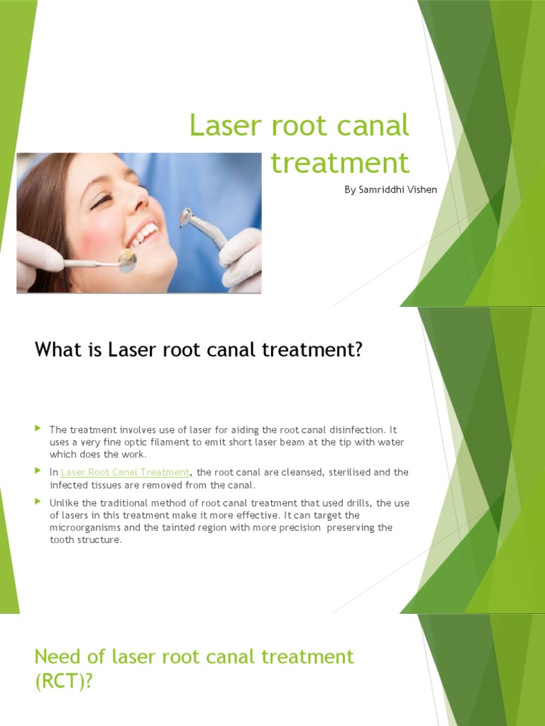 Laser Root Canal Treatment (RCT) PDF