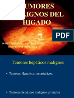 Hepatocarcinoma PDF