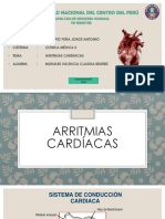 Arrtimias Cardiacas Expo
