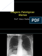 Cópia de Imagens Patológicas de Mama