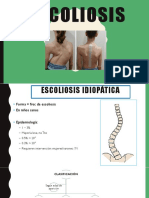 Escoliosis PDF