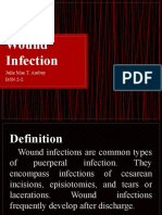 Wound Infection: Julie Mae T. Ambay BSN 2-2