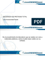 Encerado de Prótesis Total Por Luisa Alzate