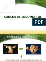 Cáncer de endometrio