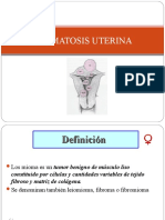 3 Miomatosis-Uterina