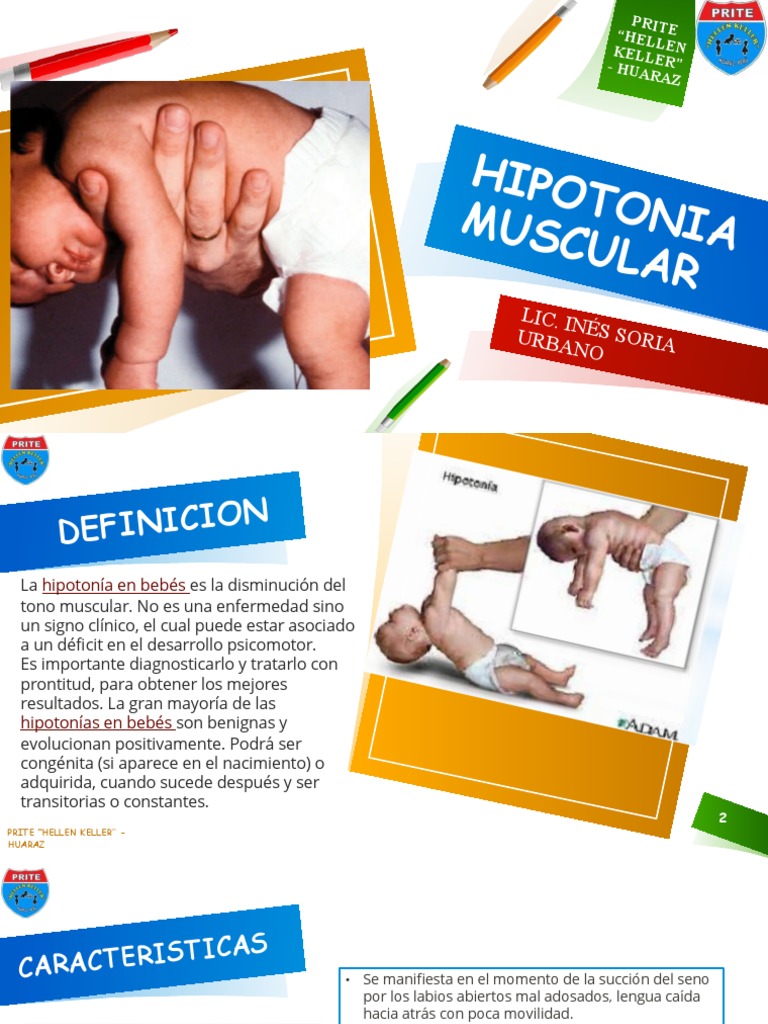 Hipotonía Muscular en Bebés y Niños | PDF | Parálisis cerebral ...