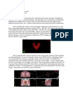 proknow prostate plan discussion with score card  1 