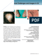 Electronic Clinical Challenges and Images in GI: Image 4