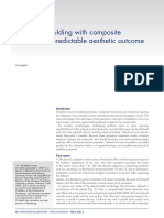 Injection Moulding With Composite To Obtain A Predictable Aesthetic Outcome PDF