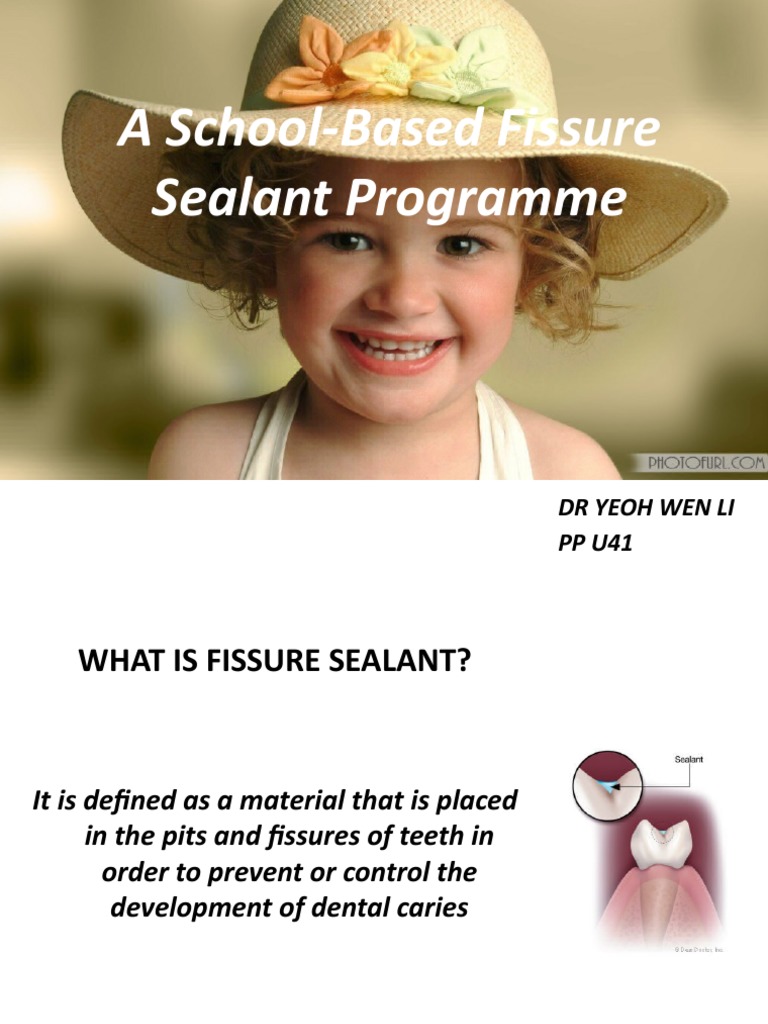 A SchoolBased Fissure Sealant Programme PDF Mouth Dentistry