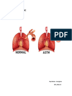 Astm Bronsic