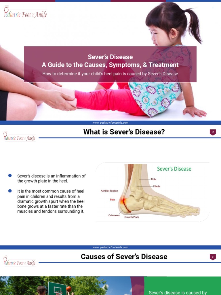 Sever's Disease A Guide To The Causes, Symptoms, & Treatment, PDF, Edema