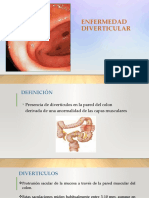 Enfermedad Diverticular