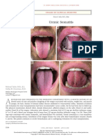 Estomatitis Uremica NEJM Caso