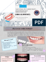 Carillas Dentales PDF