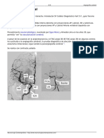 Angiografia Cerebral PDF