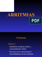 ARRITMIAS