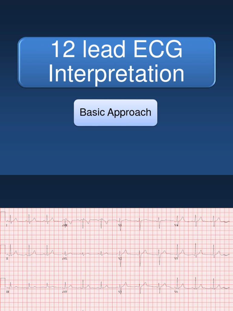 07.01 - 12 Lead ECG Interpretation 2019 | Download Free PDF ...