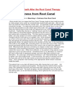 Effects of Teeth After The Root Canal Therapy