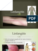 Linfangitis