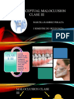 Mapa Maloclusion Iii