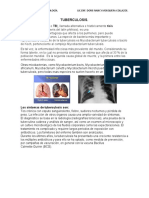 Tuberculosis Pulmonar y Extra Pulmonar PDF