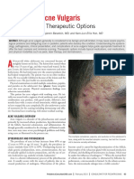 Adolescent Acne Treatment Options Overview