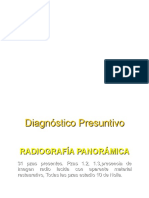 Caso Clinico Ortodoncia