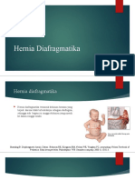 Hernia Diafragmatika Ed 1