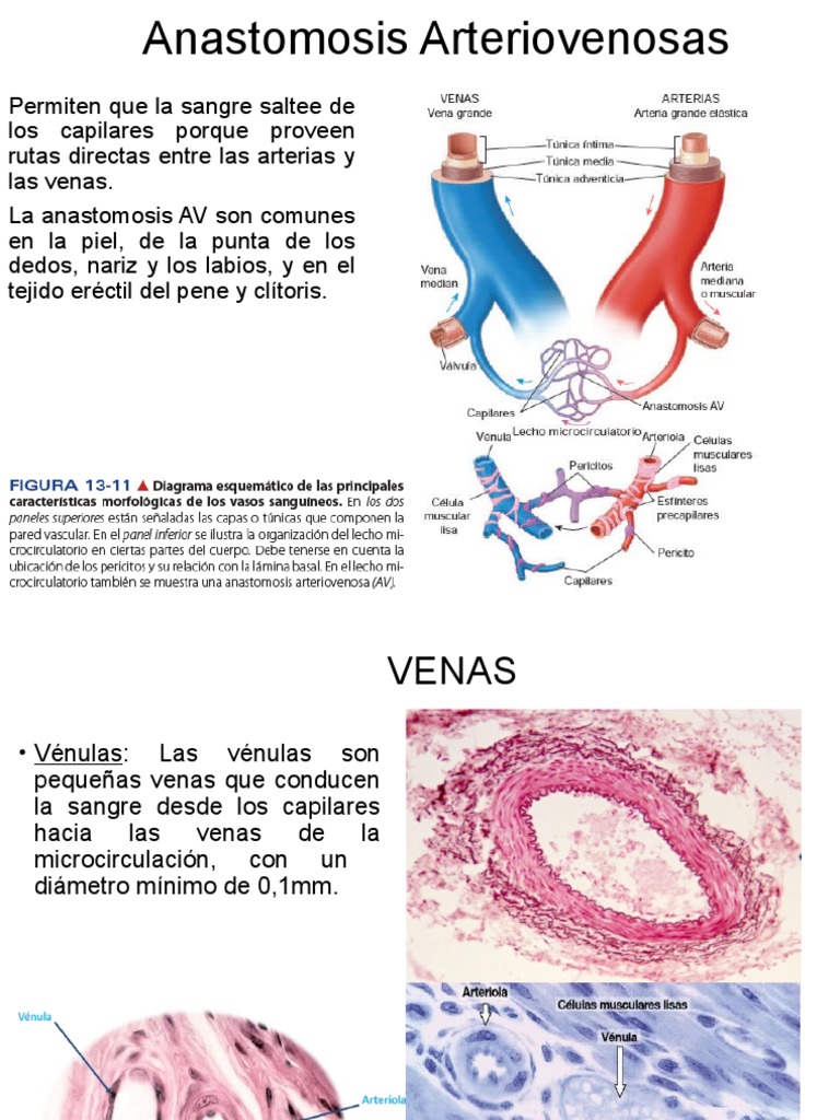 Anastomosis Arteriovenosas Venas PDF