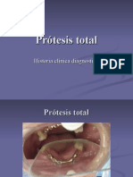 Prótesis total hc