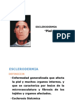 Esclerodermia