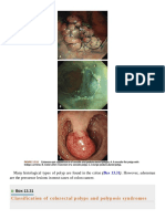 Classification of Colorectal Polyps and Polyposis Syndromes
