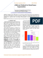 A Survey on Different Methods for BrainTumor