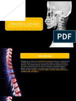 Osteofitos - Deglu