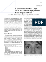 Horner's Syndrome Due To A Large Schwannoma of The Cervical Sympathetic Chain: Report of Case