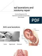 Perineal Lacerations and Episiotomy Repair
