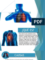 Cancer Pulmonar