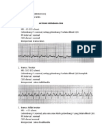 EKG (Kep Kritis)