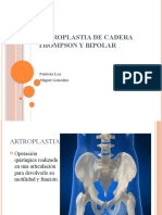 Técnica Quirúrgica de Prótesis Thompson | PDF | Cirugía | Medicina CLINICA
